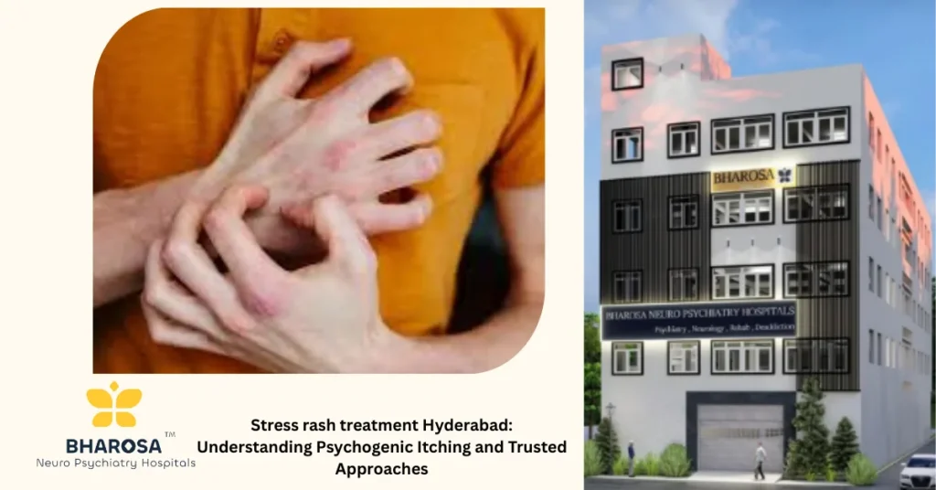 Patient discussing psychogenic itching and seeking stress rash treatment Hyderabad at Bharosa Neuro-Psychiatry Hospitals