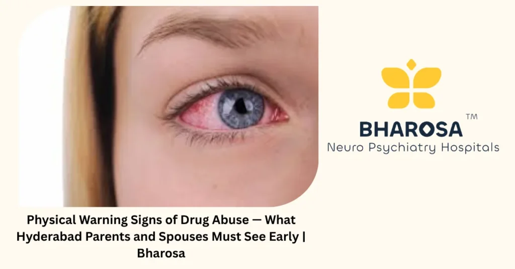 Physical warning signs of drug abuse — 7 changes Hyderabad families miss — Bharosa